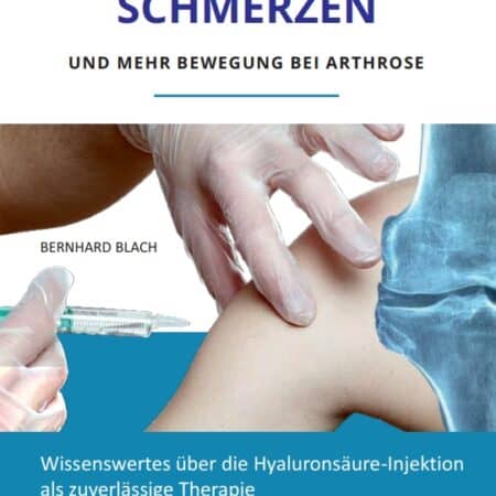 weniger Schmerzen - mehr Bewegung bei Arthrose - e-Book